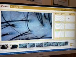 -丝客富脱发养发头皮馆