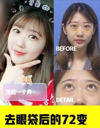-广州健丽·去眼袋医疗美容机构