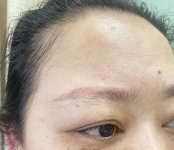 点击看大图 体验前-重庆联合丽格第五医疗美容医院