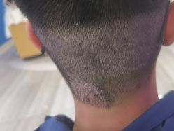 -雍禾植发全国连锁