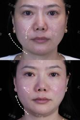 -Yestar重庆艺星医疗美容医院