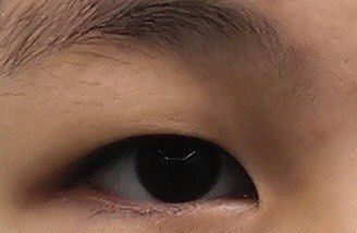 点击看大图 体验前-温州伯思立医院