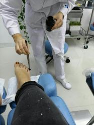 -派恩宜灰指甲鸡眼嵌甲手足癣