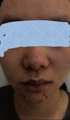 -元熙兰积皮肤管理