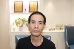 -大麦微针植发丨全国连锁