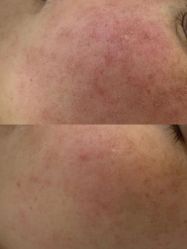 点击看大图 -蕾特恩专业祛痘·皮肤管理