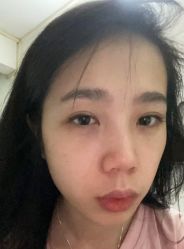 -天津健丽·去眼袋医疗美容机构