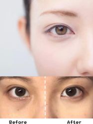 -大华韩艺整形美容医院