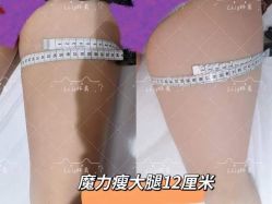 -Lily纤美·科技减脂中心
