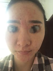 -皇族养心堂·净痘·修敏·御颜