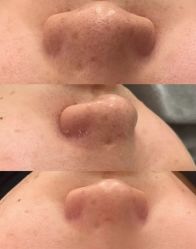 -SKIN79皮肤管理中心