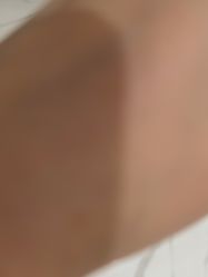 -美瑞莎创美医疗美容