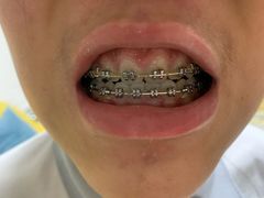 -北京大学口腔医院(第一门诊部)