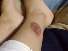 -莱蔻·圣灸堂·推拿艾灸(天山店)