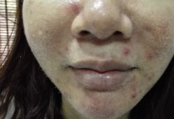 -MJ skin care国际皮肤管理中心