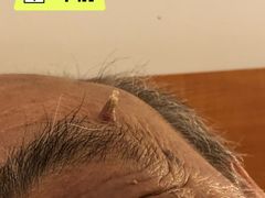 -复旦大学附属华山医院(总院)