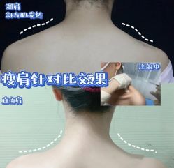 -上海漾颜医疗美容