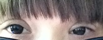 第一天-上海华安整形外科门诊部