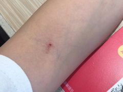-广州仁爱天河医院体检中心