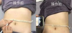 -和颜一美轻医美连锁