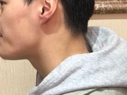 -痣缘宫