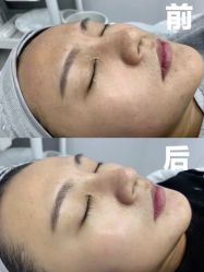 -清华大学玉泉医院-医疗美容科