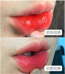 -MISS STAR·半永久纹眉·发际线·美瞳线