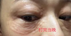 体验后-深圳广和门诊部·整形医疗美容