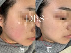 -Deeplus+韩国皮肤管理한국피부관리·C:Lab肌肤实验室
