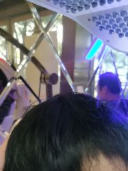 -碧莲盛·不剃发植发