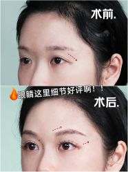 -深圳艺星医疗美容医院