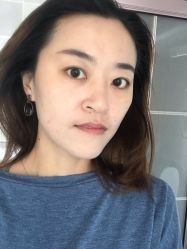 体验后-禾美嘉医疗美容