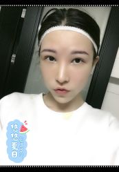 -大麦微针植发全国连锁