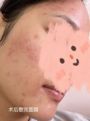 体验后-深圳美莱医疗美容医院