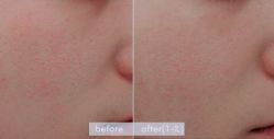 -SKINIST丽铂医疗美容
