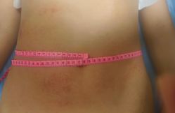 -摩瘦纤体订制减肥