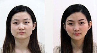 -CMS西美斯·美式医疗美容