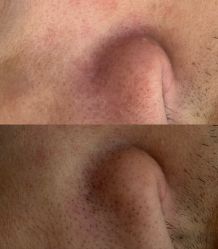 -蕾特恩专业祛痘·皮肤管理