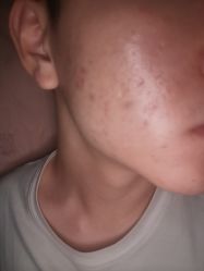 -沈阳亿美医疗美容