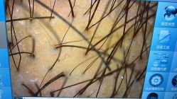 -熙朵美学植发连锁
