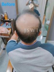 -髻尚坊增发补发织发假发定制