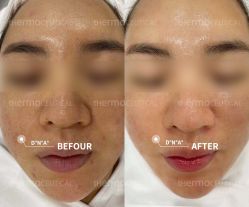 -苗方清颜痘肌研究所