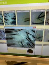 -LESSMORE科技头皮理容中心