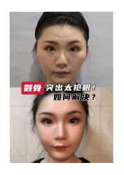 -上海时光整形外科医院