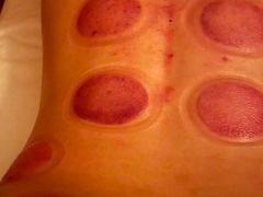 -智慧盲人按摩艾灸-颈肩腰膝疼痛调理(浦东店)