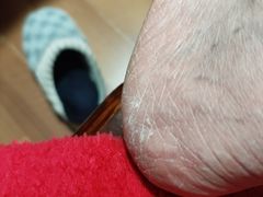 -郑远元专业修脚房(昌里东路店)