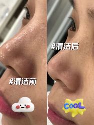 -苗方清颜专业祛痘·皮肤管理