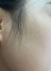 -广州美莱医疗美容医院