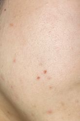 -万州华美紫馨整形美容医院