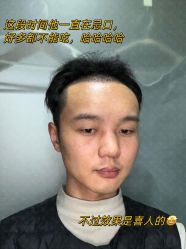 -雍禾植发全国连锁